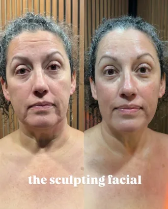 Before and after result 5